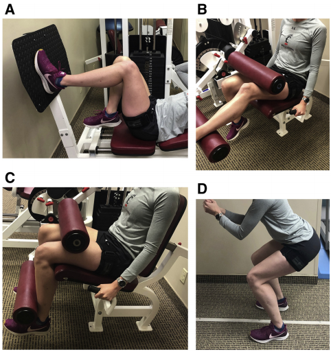 🏋️ Blood Flow Restriction Training improved peak quad and hamstring torque measurements after just 9 sessions in the majority of patients with severe strength deficits who had failed to respond to standard rehab🦵
ow.ly/M5jJ50G5JkX
#rehab #strengthgains #quadatrophy #bfrt