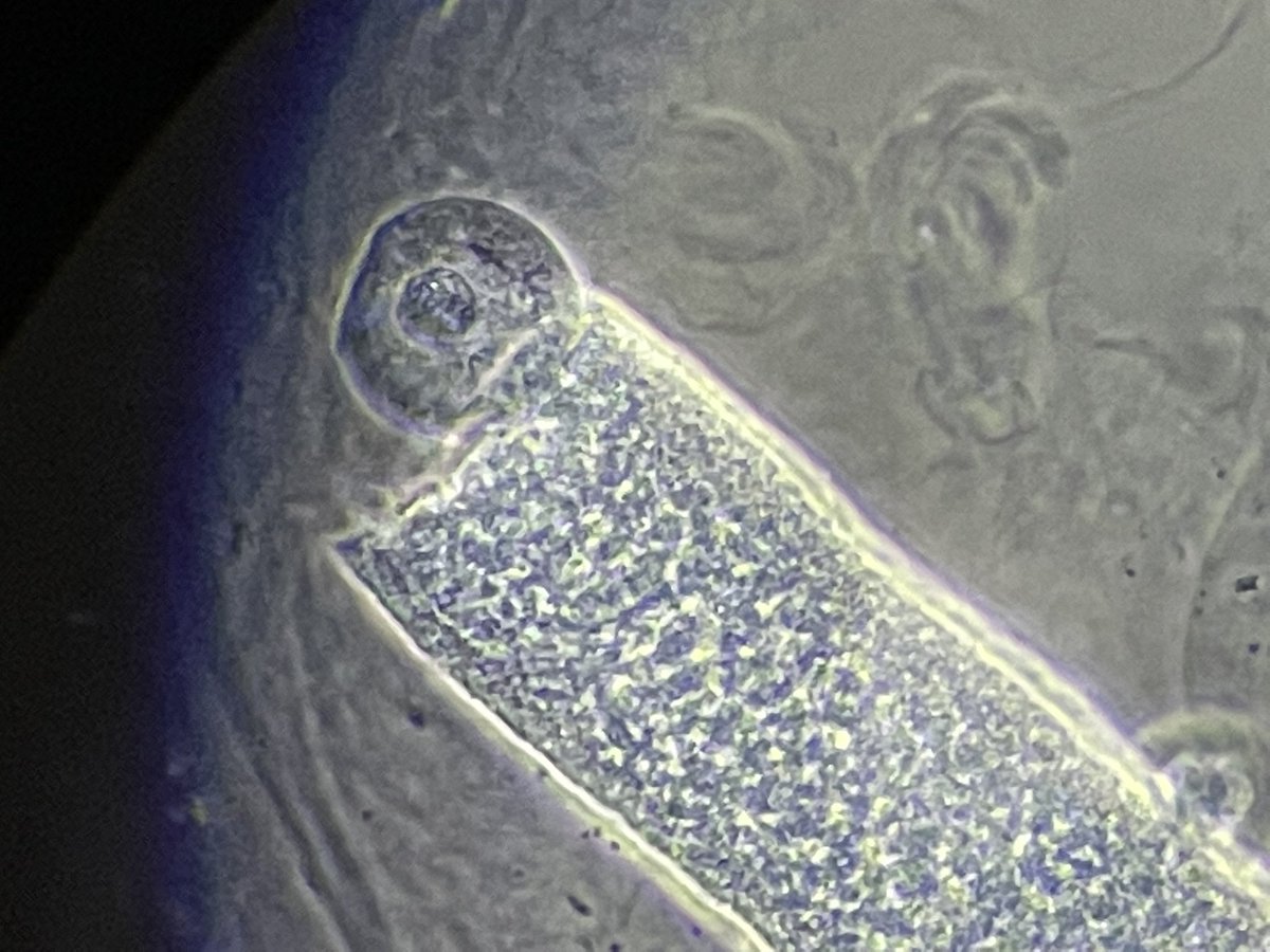Nephro_Ivan's tweet photo. Cilindros granulosos y uno con par de leucocitos 😀
#urinarysediment
#urinaryMicroscopy https://t.co/3QPgEah8BR
