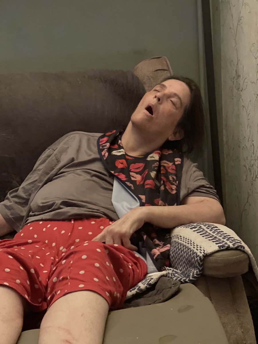 HDawareness This is Huntington’s disease,they don’t show images like this on soap operas on tv,just talk bolocks about Huntington’s