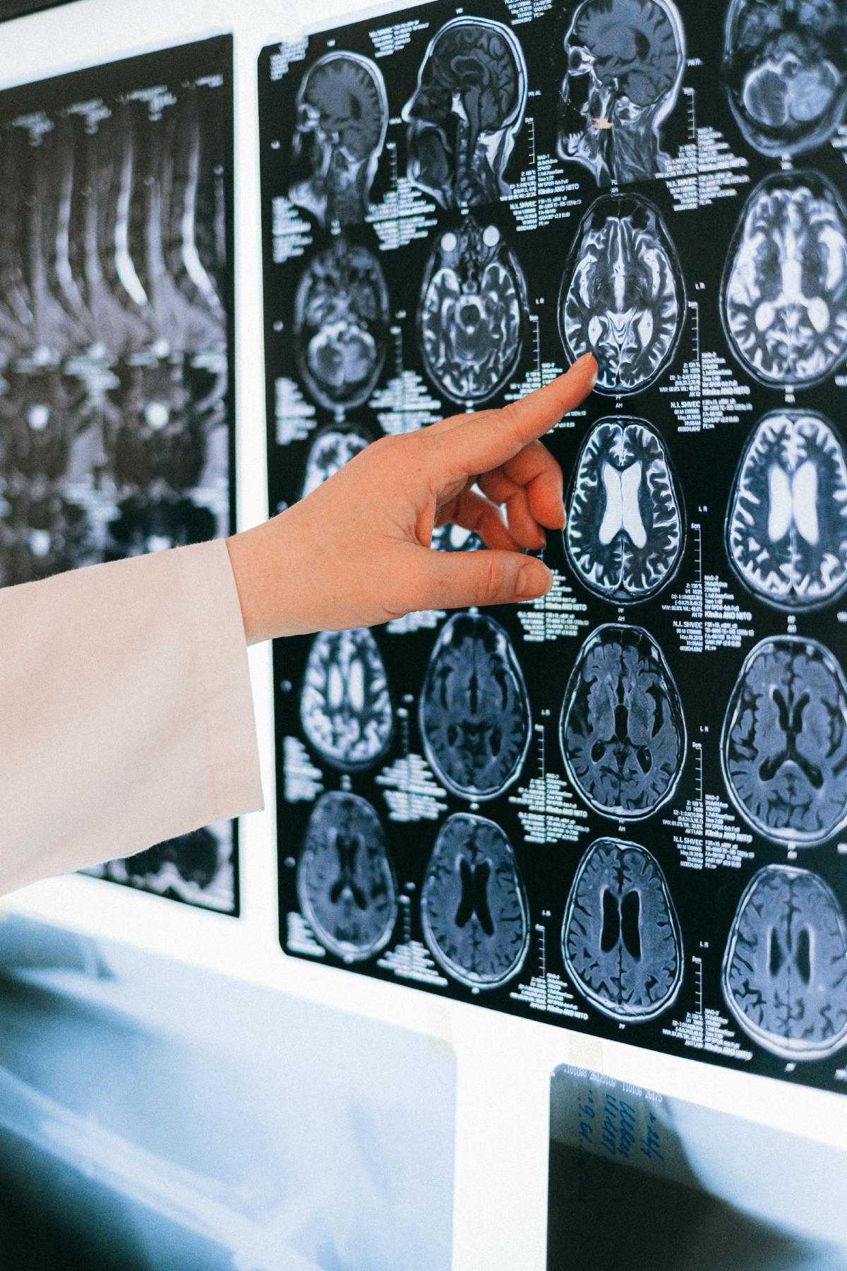 integrated neuropsychological services fayetteville ar
