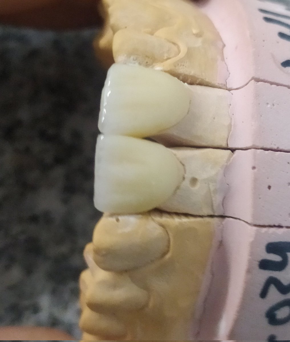 mo3ttar's tweet photo. بنت داخلة ٣ ثانوي واصحابها بيتنمرو عليها بسبب شكل اسنانها 
الحمد لله نتيجة جميلة والبنت خارجة مبسوطة ده عندي بالدنيا ♥️♥️♥️ https://t.co/wPoLyR4YHq