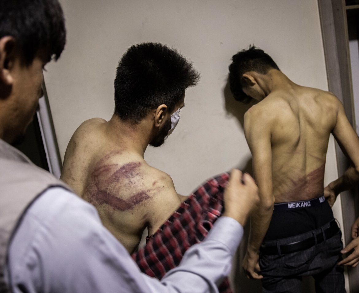 margothaddad's tweet photo. 🔴🇦🇫 #FOCALE Des journalistes afghans battus par les #talibans pour avoir couvert une manifestation à #Kaboul.
📸 Pic by @jimhuylebroek pour le New York Times #Afghanistan https://t.co/W3k68NxTwM