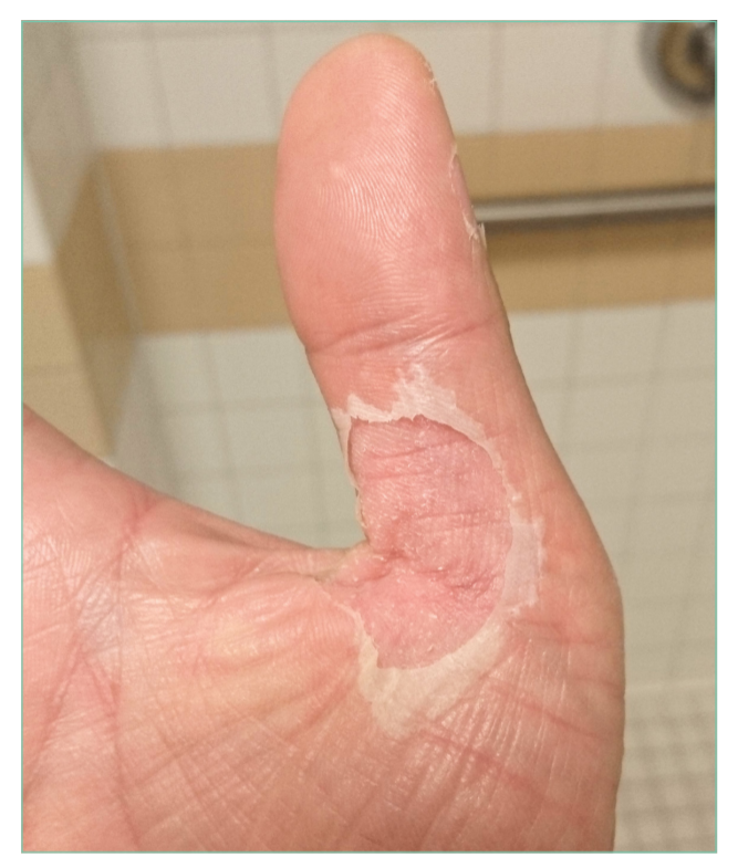 Journal of Hospital Medicine tweet media