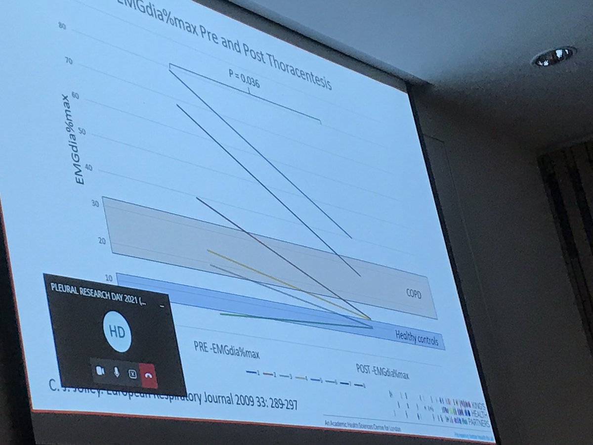 Lovely EMG data from <a href="/d33pan/">Deepan Sivakumar</a> pre and post therapeutic pleural aspiration. Neural respiratory drive is high pre-drainage - higher than for many COPD patients. Mostly figures improves after fluid removal, but small numbers. Interesting work. #PRD2021 <a href="/UKPleura/">UK Pleural Society</a>