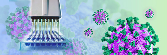 New SARS-CoV-2 Neutralising Antibodies Detection Kit from <a href="/AdipogenLifeSci/">AdipogenLifeSciences</a>! Now available for the detection of neutralising antibodies against variant Delta!

To know more:
lnkd.in/dRDVJjH and lnkd.in/dGC3fvkb

Or contact us: lnkd.in/gabUk