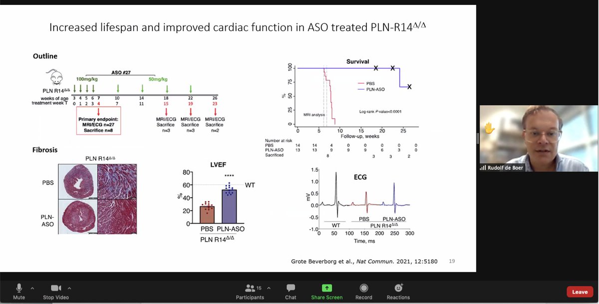 National NL collaborative efforts to tackle sudden cardiac death. Discussions spanning genetic, clinical and mechanistic studies in inherited cardiac disorders during the CVON-PREDICT2 consortium meeting. <a href="/CarolRemme/">Carol Ann Remme</a> <a href="/jpvantintelen/">J.Peter van Tintelen</a> <a href="/rudolf_deboer/">Rudolf de Boer</a> <a href="/J_Bakkers/">Jeroen Bakkers</a> <a href="/ArthurWilde5/">Prof. Arthur Wilde</a>