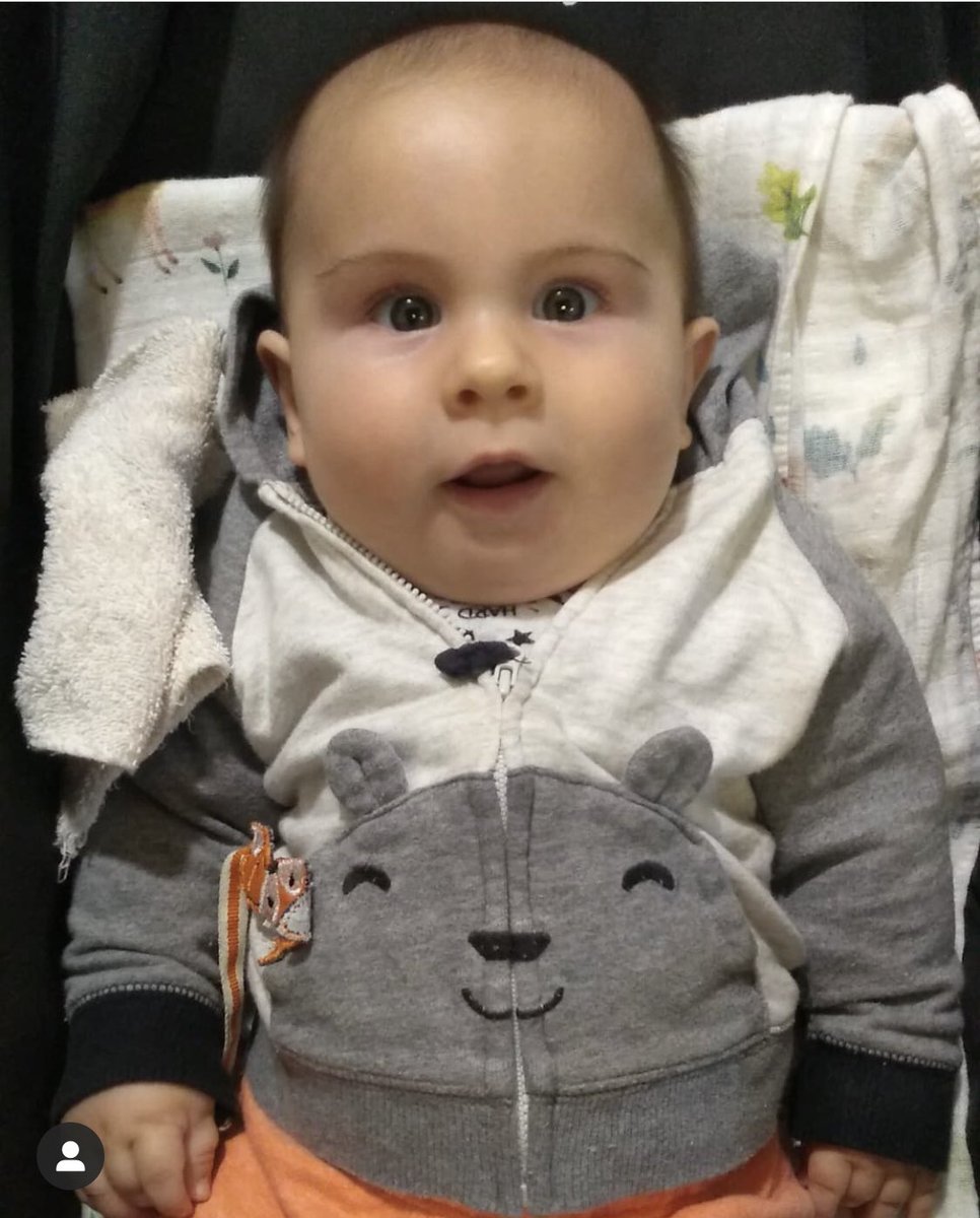 yaninaelola's tweet photo. Bauti tiene 6 meses y fue diagnosticado con AME 1. necesitamos que @ospesalud autorice su tratamiento YA! Cada día qué pasa la enfermedad avanza y su salud se deteriora. Ayúdanos a compartir.#AME1 #spinrazaparatodos #todosconbauti @msalnacion https://t.co/aZv8mwY0tM