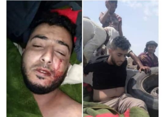 سنقوم بتدويل قضية المغدور به من قبل مليشيات الانتقالي الإماراتي
#الشهيد_عبدالملك_السنباني