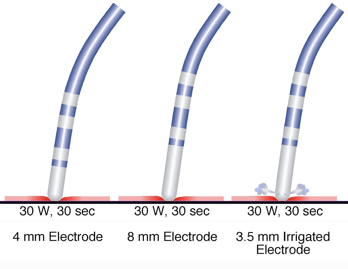 #IssaTweetorials #EPeeps 1/10 Q: If you could deliver 30 W of RF energy for 30 sec using any of the ablation (abl) electrodes shown in the figure, which RF ablation catheter creates larger ablation lesion size? A: Let’s talk about how the RF abl lesion is formed.