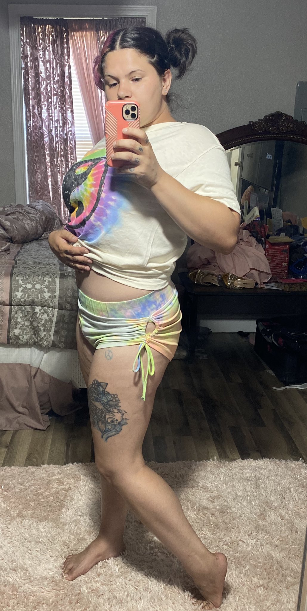 100 days post-op https://t.co/iph8rAQ8FB
