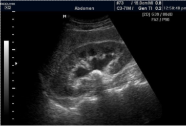 Today we're happy to start what we hope will be a new tradition: POCUS Friday! Tweet us what you think the image is depicting and we'll tweet the answer on Monday!