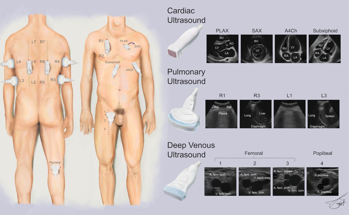 ThoraxBMJ tweet media