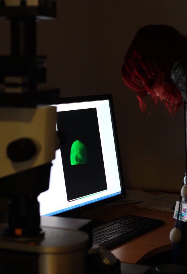 celltechslab's tweet photo. Welcome to CellTechs! On travaille sur les cellules souches et les organoïdes pour mieux comprendre les maladies neurodégénératives. Sur ce fil Twitter vous aurez un aperçu de la vie du labo ! #stemcells  #biotechnologie #alzheimer #VismaViedeChercheur https://t.co/5IoHGyxHxz