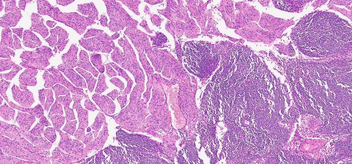 Ankur Sangoi tweet media