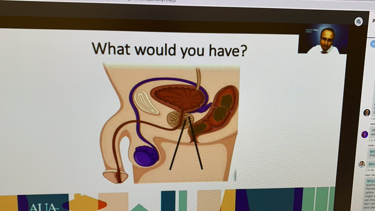 RSanchez_Salas's tweet photo. My Family, my friends and myself should be far away from transrectal prostatic biopsy!! @DrRastinehad and team taking old ideas away #AUA21 @LondonProstate1 @arvinkgeorge @peterchiu_uro @ThomasPolascik  “if you dont  want to buy many Mazdas just buy Mercedes” @FocalSociety https://t.co/7NgI31dkuR