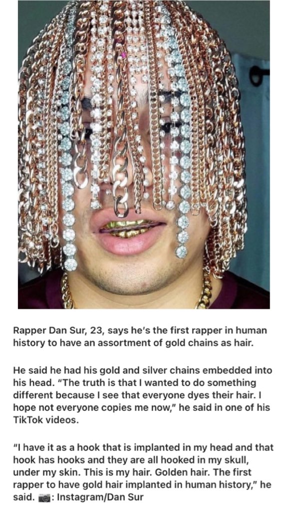 Meet The Mexican Rapper With Gold Chains Implanted In His Scalp