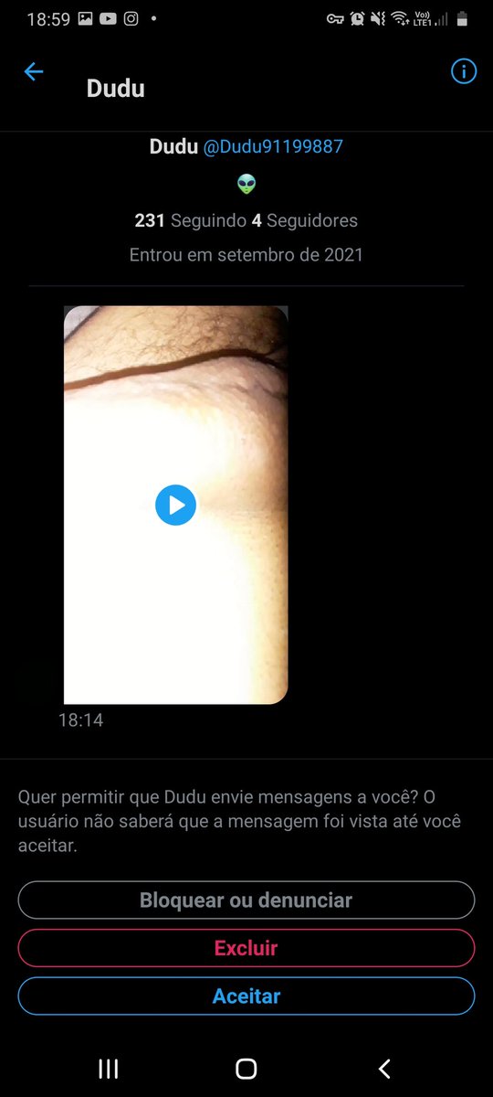 little_mouseee's tweet photo. Nojento escroto
Respeita quem ta trabalhando no meio, seu punheteiro de merda
Ninguém quer ver esse pinto podre não, babaca 
Tem que expor pra passar vergonha e ver se aprende a ser gente
@Dudu91199887 https://t.co/KOeUiQRLt1