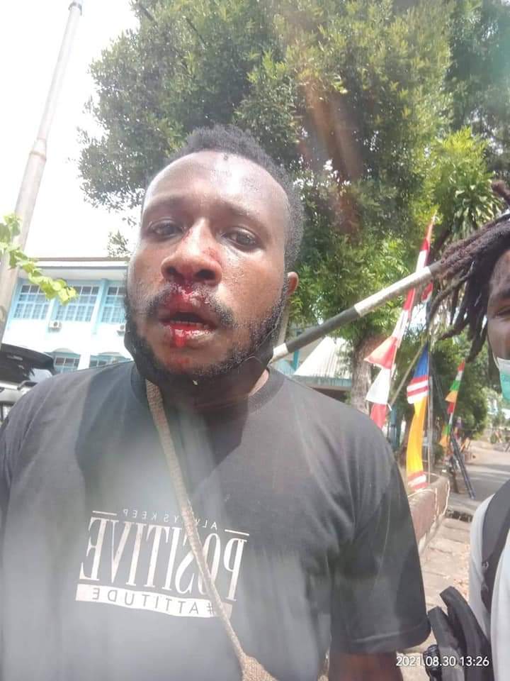 HNSobolim's tweet photo. Saat ini massa aksi yang tergabung dalam Aksi Duduki Kantor Kejaksaan Tinggi Papua karena lambatnya penanganan kesehatan terhadap Viktor Yeimo oleh Kejasaan Tinggi Papua berujung penangkapan dan pemukulan oleh aparat TNI/POLRI. #freevictoryeimo https://t.co/7tusTbqAjE