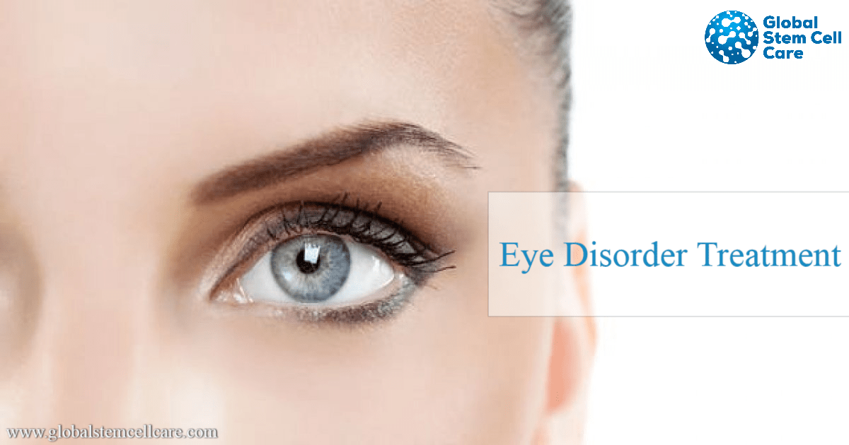 globalstemcellC's tweet photo. Do you Know about Eye Disorder?
To know more about #EyeDisorder visit, https://t.co/PhQ3HSU9GU
#eyedisease #visionloss #stemcelltherapyindelhi #stemcelltherapyforeyedisorder #eyediseasesymptoms https://t.co/7RnmTfSYiE