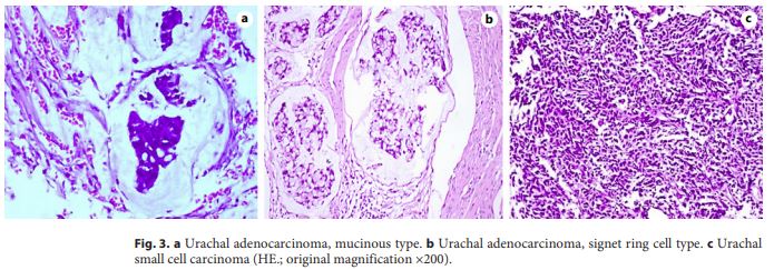 LatestKarger's tweet photo. #OpenAccess
Clinical, Pathological, and Prognostic Analysis of Urachal #Carcinoma
✍ Shao G. et al. @ShandongU
👉️ https://t.co/qYncvyayuy
#KargerPublishers #UrolInt https://t.co/u3zZ58Knli