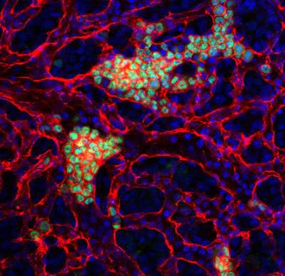 hevaresearch (@hevaresearch) on Twitter photo 🆕We are thrilled to announce that our editorial on the Research Topic
Fetal/Embryonic Hematopoietic Progenitors and Their Impact on Adult Diseases is now complete and online!
👉🏻online <a href="/FrontiersIn/">Frontiers</a>
frontiersin.org/research-topic…
<a href="/silviabrunelli_/">Silvia Brunelli</a> <a href="/unimib/">Università degli Studi di Milano-Bicocca</a>
<a href="/lunduniversity/">Lund University</a>
#research 🆕We are thrilled to announce that our editorial on the Research Topic
Fetal/Embryonic Hematopoietic Progenitors and Their Impact on Adult Diseases is now complete and online!
👉🏻online <a href="/FrontiersIn/">Frontiers</a>
frontiersin.org/research-topic…
<a href="/silviabrunelli_/">Silvia Brunelli</a> <a href="/unimib/">Università degli Studi di Milano-Bicocca</a>
<a href="/lunduniversity/">Lund University</a>
#research