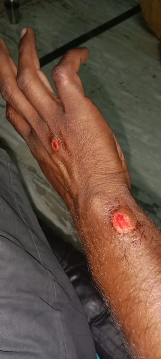 TGPWU's tweet photo. 2. Did @swiggy_in bothered to provide emergency support or compensate for the loss of earning due to the accident? No. Rather it impose order penalty on the worker. Inhuman @SwiggyCares .
#WeAreIFAT #WeAreTGPWU #DeliveryLivesMatter #DriverPowerUnionPower https://t.co/WmnisLGvHJ