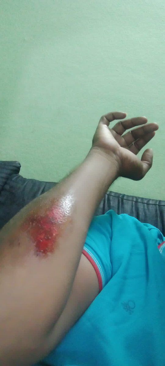 TGPWU's tweet photo. 2. Did @swiggy_in bothered to provide emergency support or compensate for the loss of earning due to the accident? No. Rather it impose order penalty on the worker. Inhuman @SwiggyCares .
#WeAreIFAT #WeAreTGPWU #DeliveryLivesMatter #DriverPowerUnionPower https://t.co/WmnisLGvHJ