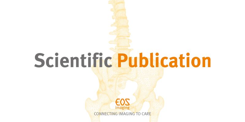 This algorithm "allows surgeons to make appropriate evaluations preoperatively, and it guides the use of dual mobility components in patients with spinopelvic pathology in order to reduce the risk of dislocation in these high-risk patients." pubmed.ncbi.nlm.nih.gov/34192913/
