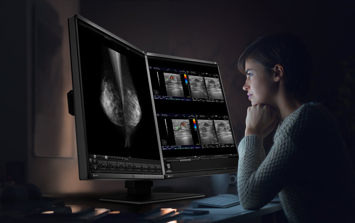 monitorsdotcom's tweet photo. Focus on your work with the high-definition, Eizo RX560 5MP Color LED Mammo 3D-DBT Breast Imaging Display.
#radiology #xray #radiologia #medicine #radiologist #medical #medlife #radtech #radiologytech #xraytech #doctor #healthcare #radiographer #radiologystudent #imaging https://t.co/LggJyZ9OAk
