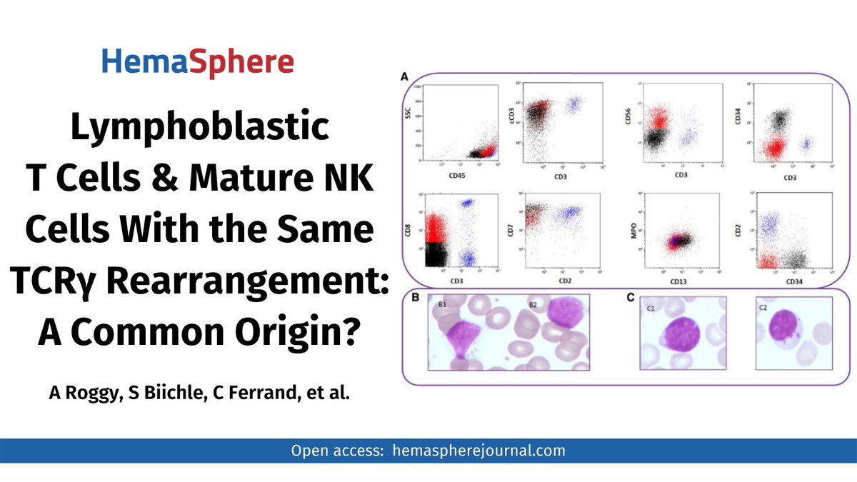 Hemasphere_EHA's tweet image. 🔎Case report: a proliferation of blast cells expressing T antigens, assoc. with mature NK proliferation. Can excess LGL assoc. with T or NK lymphoblastic proliferation be considered as potentially #clonal? Read more 👉bit.ly/3joIkxX
#AcuteLeukemia #leukemiastemcell