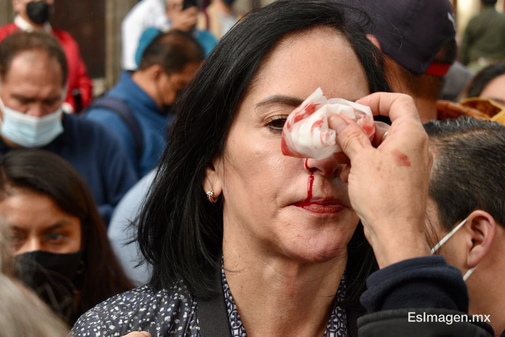 Esta fotografía los perseguirá muchos años.