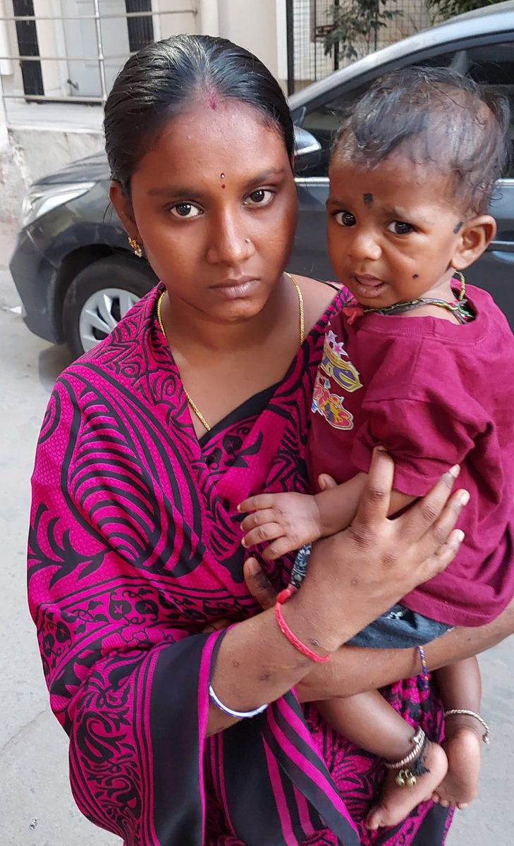 amjedmbt's tweet photo. .@KTRTRS Sir,Jayansh-7 months suffering from heart disease needs to be operated for VSD Surgical Closure at STAR Hospital has given estimation of Rs/ 2.19 lakhs, her parents are very poor belongs to SC (Madiga),Kindly ask @KTRoffice to cont Sarika on 9550048927 and help. https://t.co/RcwMFj8tu4
