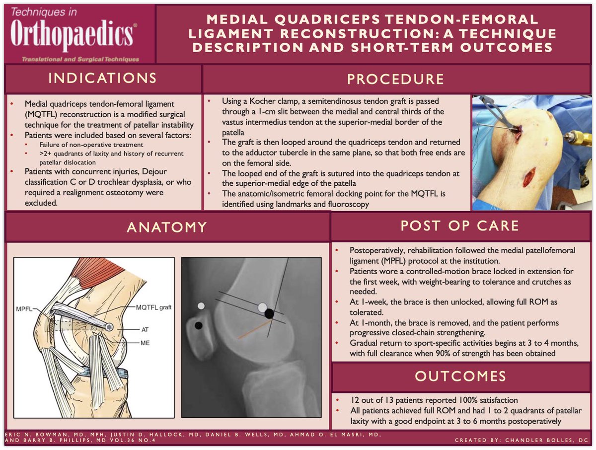 Our latest #VisualAbstract is out! "Medial Quadriceps Tendon-Femoral Ligament Reconstruction: A Technique Description and Short-Term Outcomes”

#Orthopedics #orthotwitter #orthopaedics #orthopedicsurgery