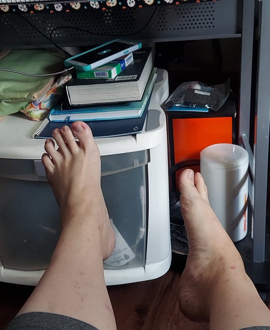 Ya know, if it weren't for the scars, I think my feet at cute. Ok cute in a quirky, wtf happened to your<a href="/tag/adultwork"class="tags"><span>#adultwork</span></a>