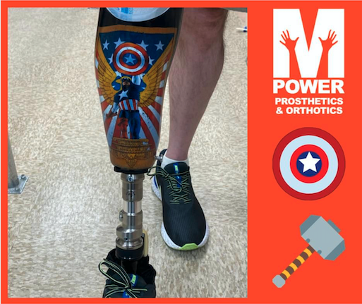 FreedomInnovate's tweet photo. Shout-out out to the team at @MPowerPO for a job well done with this AWESOME build using the all-new RUSH ROGUE® 2!
Learn more here: https://t.co/gImUSuDmwX
#goROGUE #RUSHFoot #WeAreProteor #Prosthetics https://t.co/S8ZOkoalrz