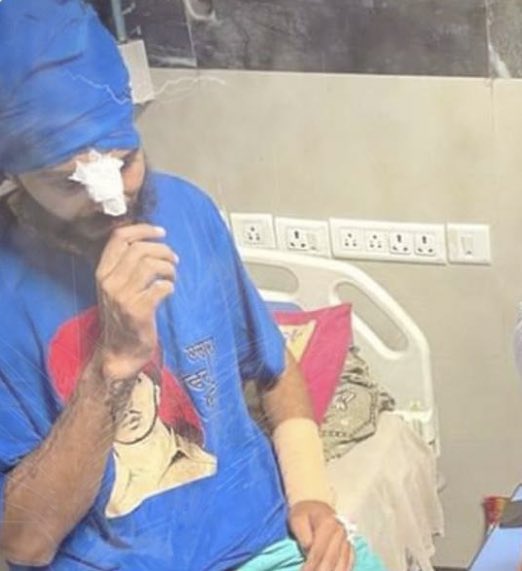 SherniBanke06's tweet photo. Gurjant Singh whose nose was broken in karnal attack has lost 50% eyes sight 
 shame on you @police_haryana 
#KisanMurderer_AyushSinha
#FarmersProtest https://t.co/Be7D4ZCami