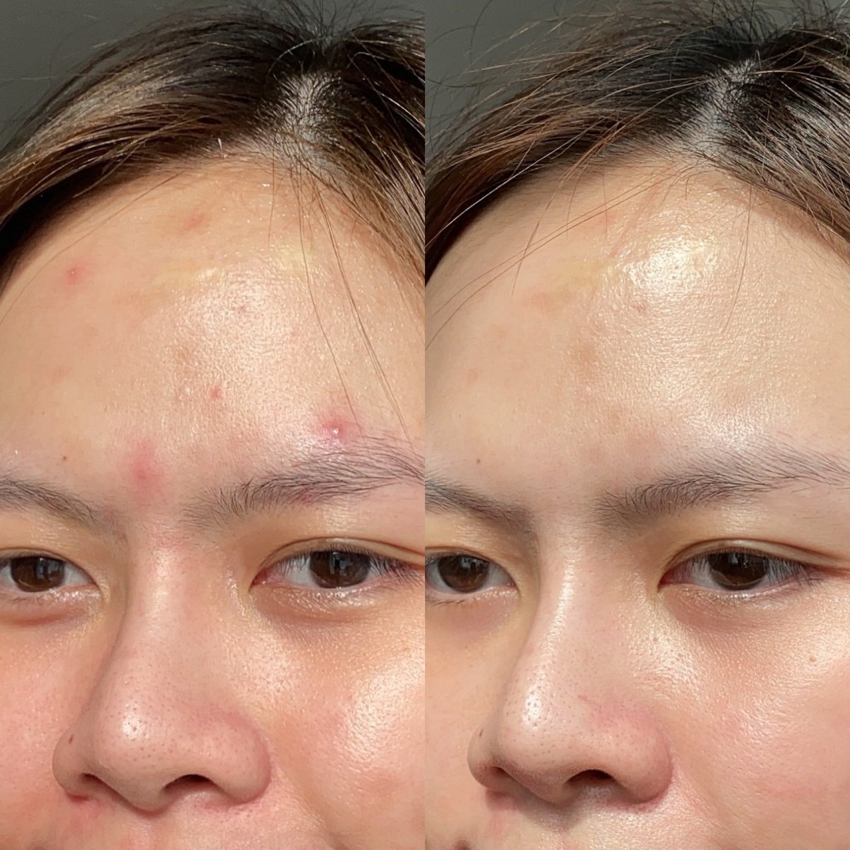 Nananblogblog's tweet photo. Bioderma Sebium Sensitive ที่ใช้มาจนต้องบีบหลอดแล้ว คนที่กำลังหาครีมเนื้อเบาๆ ไม่เหนอะ ช่วยเรื่องผิวอ่อนแอเป็นสิวง่าย ส่วนตัวชอบใช้ในช่วงกลางวันก่อนเเต่งหน้า ผิวมันเเมตต์ๆดี (ผลลัพธ์เพิ่มเติมใน mt)
📍ซื้อมาจาก Boots ค่ะ
#BIODERMA #ผิวผสมเเพ้เป็นสิวง่าย #SebiumSensitive https://t.co/VEwtHppcOu