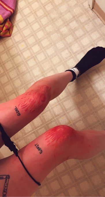 Almost done 🩸💉 https://t.co/T8TfA0N0hF<a href="/tag/newprofilepic"class="tags"><span>#newprofilepic</span></a>