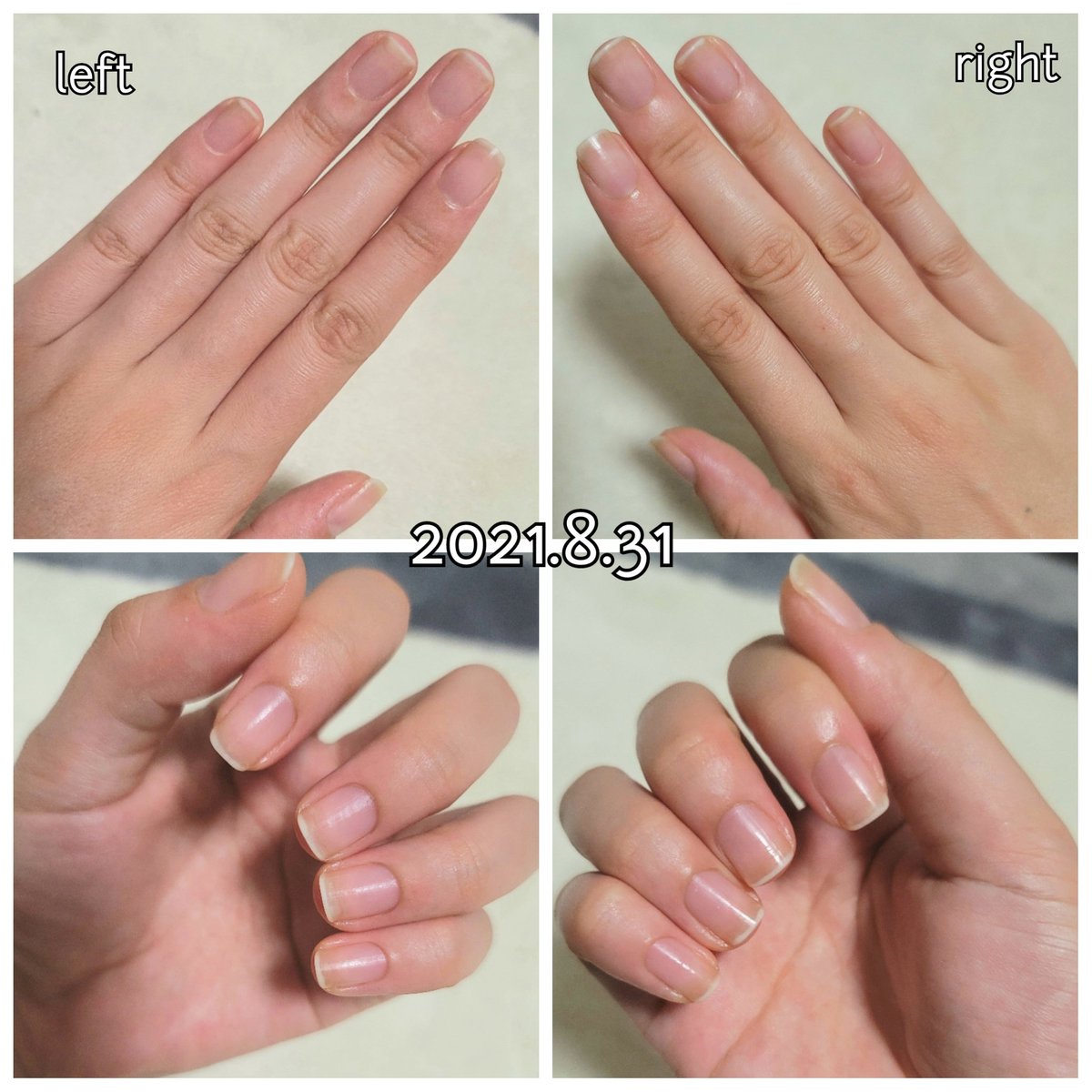 咲弥 元爪噛みの育爪記録 Hands Nail تويتر