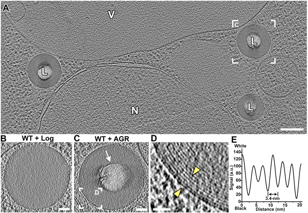 HenneLab's tweet photo. New preprint! Here we dissect how cells create "liquid-crystalline lattice" lipid droplets (LCL-LDs).

How does fat crystallize, you may ask?

We find TAG lipolysis causes sterol-esters in LDs to transition from a disordered to a liquid-crystalline phase.

https://t.co/AvuniZKhoF https://t.co/OBW4Ev4kcT