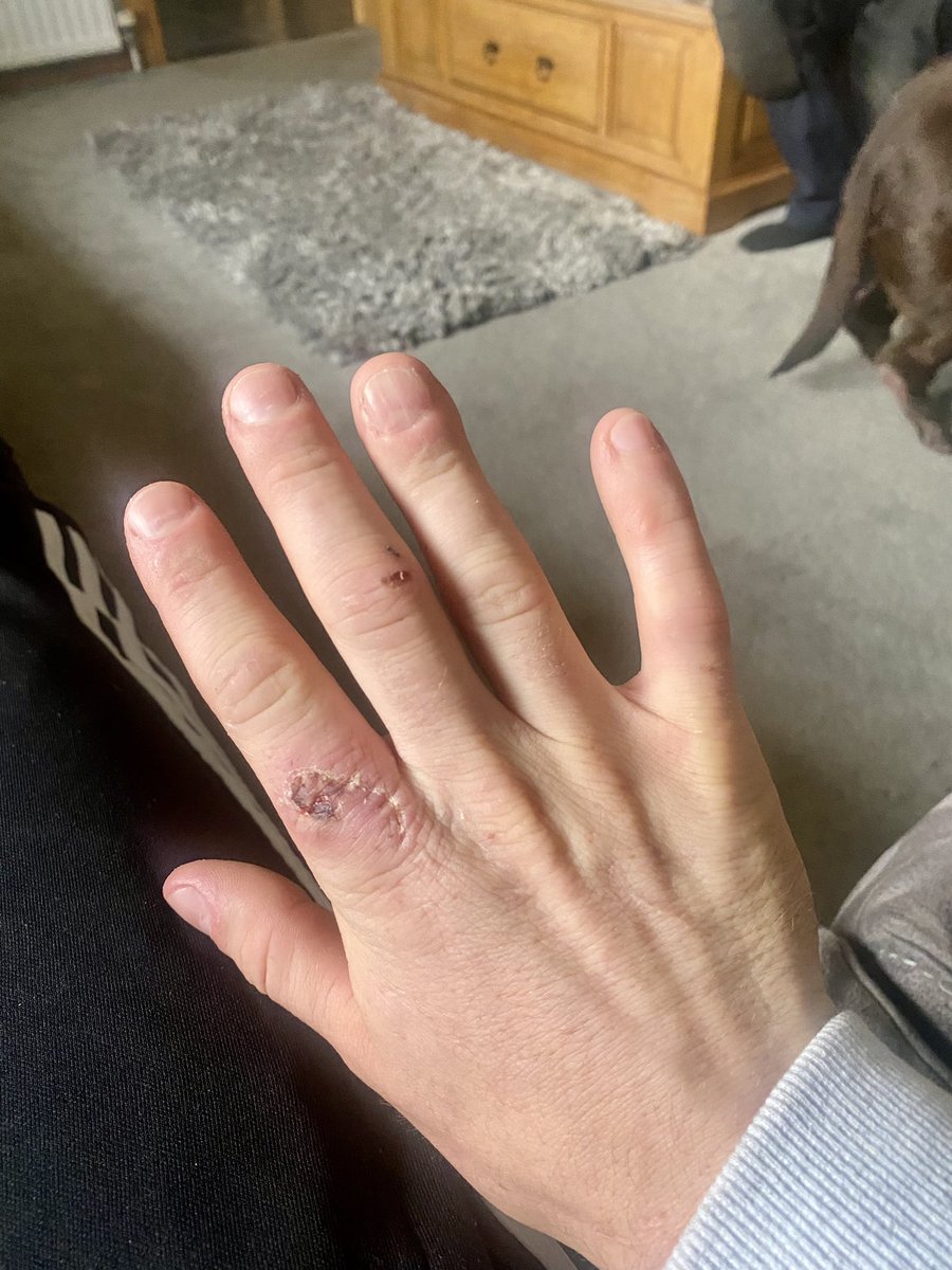 Fair to say my hand modelling career is out the window now