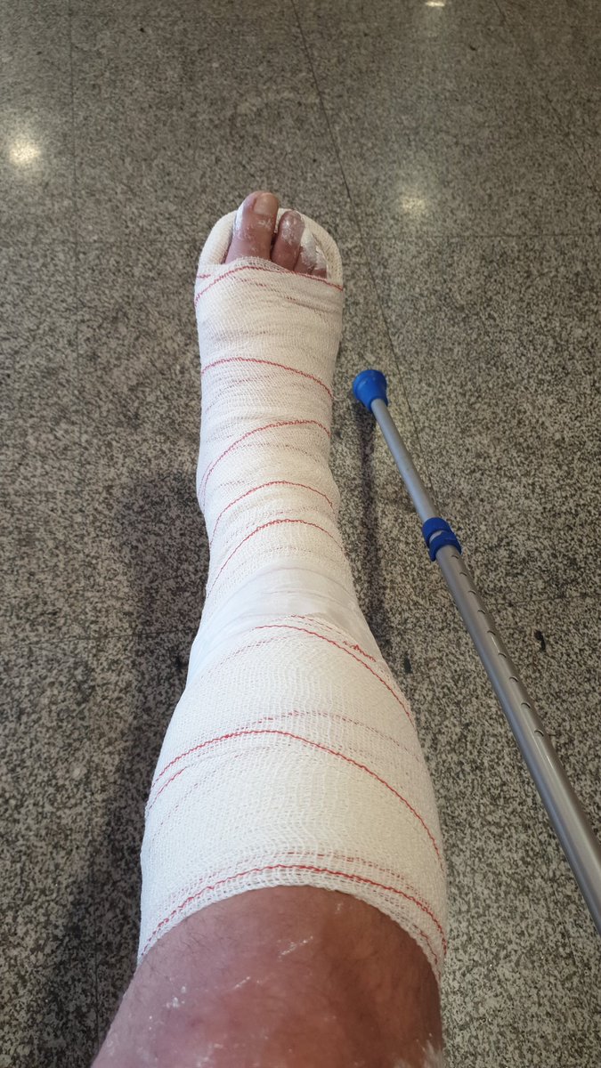 Asfaltar calles que están practicamente perfectas y dejar otras durante años en total abandono tiene sus consecuencias. Hoy me ha tocado a mi, no he sido el primero ojalá sea el último. <a href="/JMDCiudadLineal/">Distrito de Ciudad Lineal</a> <a href="/Lineamadrid/">Línea Madrid</a> <a href="/CsCiudadLineal/">CS Madrid C.Lineal</a> <a href="/AngelNinoQ/">Ángel Niño</a> <a href="/policiademadrid/">Policía Municipal de Madrid</a> <a href="/MADRID/">Ayuntamiento Madrid</a>