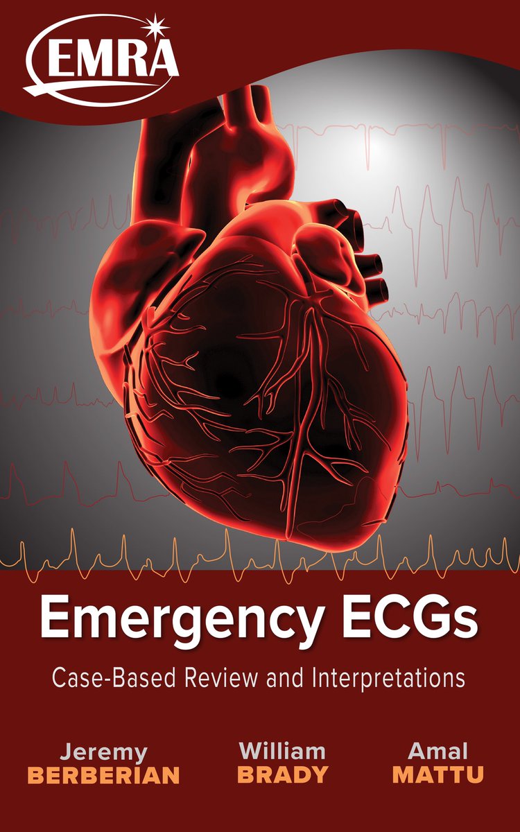 jgberberian's tweet photo. Super proud of this book. @emresidents @amalmattu https://t.co/V98a9CC1hk