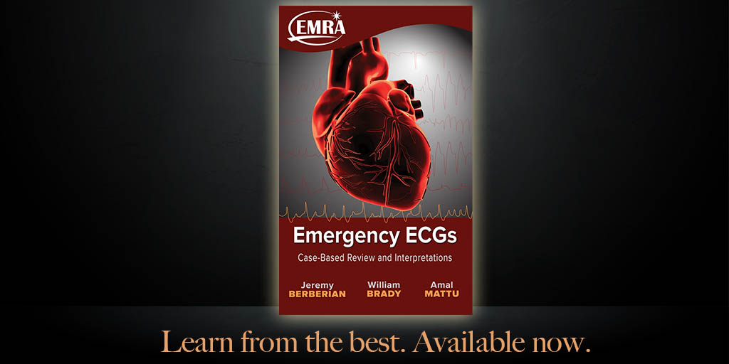 emresidents's tweet photo. It’s always a good time to brush up on your ECG knowledge with @jgberberian @amalmattu and William Brady. There may or may not be some surprises here…take a look! 
https://t.co/ohv7kHAbM2 https://t.co/gDRuTbAwIr