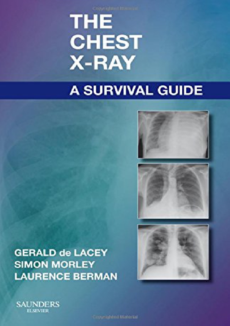 Chest X Ray Pdf Active Learning Template Student Name vrogue.co