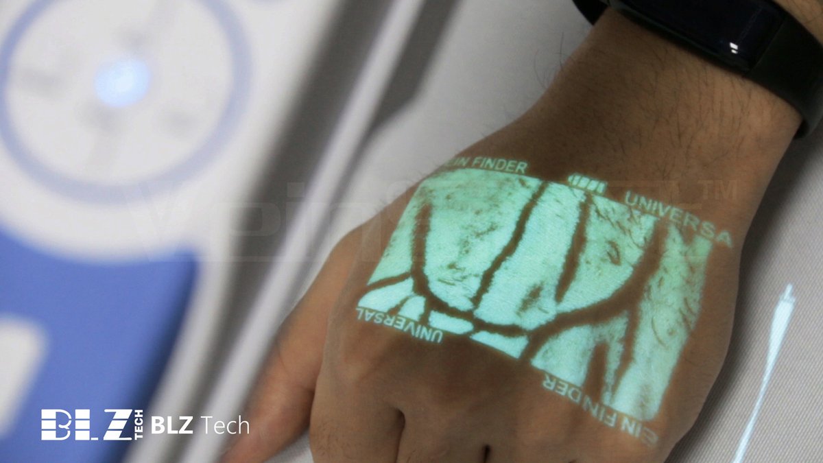 FinderVein's tweet photo. #Veinfinder is able to make lot of things easier for caregiving professionals when it comes to finding the veins easily and quickly. Its importance can be realized easily in #emergencies when every single moment counts to save lives. 
Find more:https://t.co/hk1O4l6wCK
#healthcare https://t.co/3LLupIYzqb