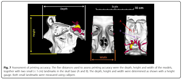 Dan_J_Gillett's tweet photo. #3Dprinting of pituitary tumours. We critically compared four 3D printing techniques and also asked @CUH_NHS and @Cambridge_Uni experts their opinions. The article is available here https://t.co/UprLTm15Gg 
@djmars811 @BioMedCentral @josefprusa https://t.co/jZQgDcfDAw