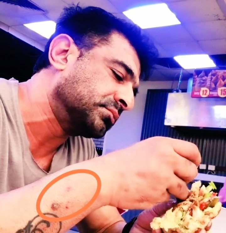 Khan358Nigar's tweet photo. Ye kya hua h @KhanEijaz hope so jayada kuch nhi hua ho,aap thik toh h
#ek46
#EijazKhan https://t.co/IAcfrxULZC