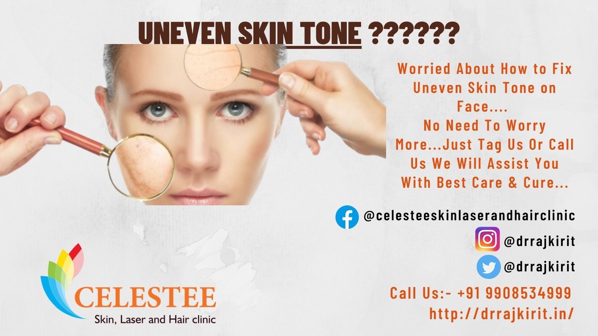 drrajkirit's tweet photo. 👉Worried About #UnevenSKinTone ??
Or Tired Of Trying Many #Remedies But No #Results ??
👉Stop Your Worries Just #TagUs We Will #Assist You With Best Care &amp; Remedies
Facebook:- @celesteeskinlaserandhairclinic
Instagram, Twitter - @drrajkirit
📱9908534999
#DrRajKirit #Filmnagar https://t.co/9P1xhyMSne