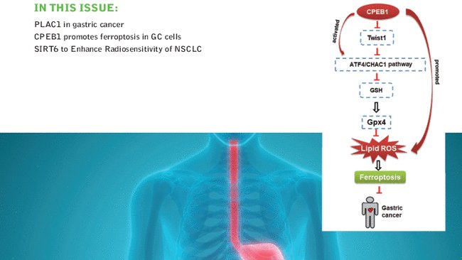 🍂September and a new Issue of @IUBMB Life. Read here: iubmb.onlinelibrary.wiley.com/toc/15216551/2… 🔻#PLAC1 in #gastriccancer 🔻#CPEB1 promotes #ferroptosis in #gastriccancer cells 🔻#SIRT6 to Enhance Radiosensitivity of #NonSmallCellLungCancer